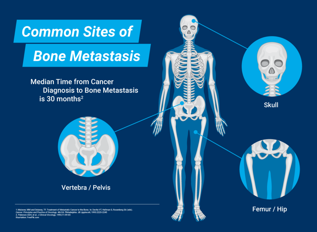 Musculoskeletal Oncology Specialists | Baton Rouge Orthopaedic Clinic